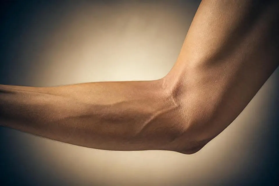 Ilustração anatômica do trajeto do nervo ulnar